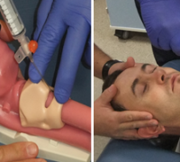cricothyroidotomy